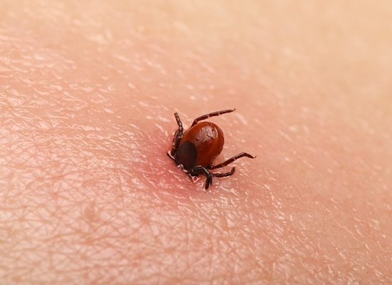 Getting Rid Of Ticks